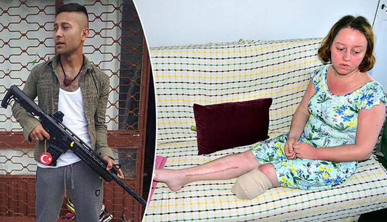 Eşini vurup bacağının kesilmesine neden olan sanık için 20 yıla kadar hapis istemi