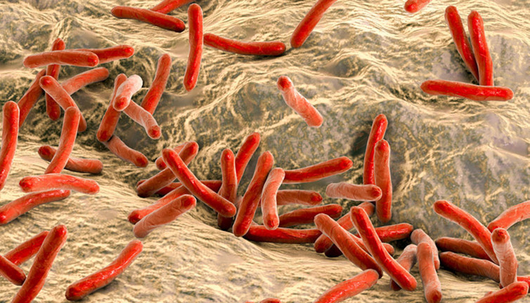 Erken tedavi edilmediğinde öldürücü olabiliyor