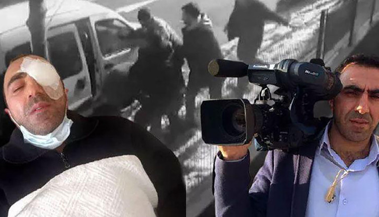 Avcılar'da kaza sonrası nakilli gözü kör eden yumruk