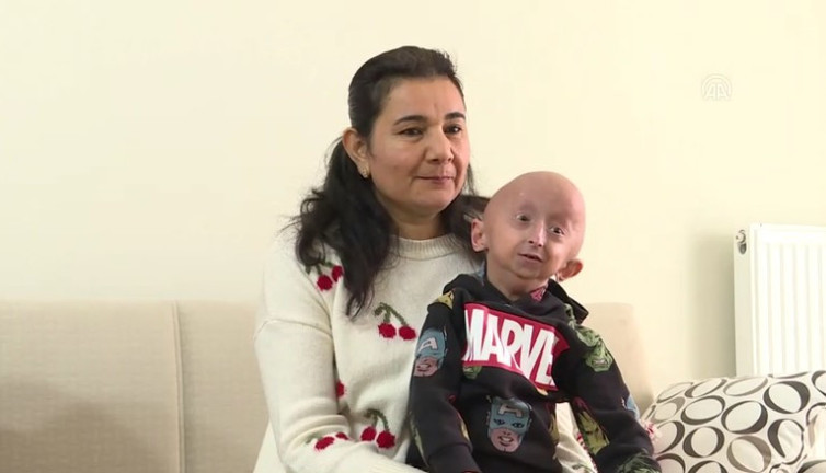 8 milyonda 1 görülüyor | 9 yaşındaki Veysel’in “Benjamin Button” hastalığıyla mücadelesi!