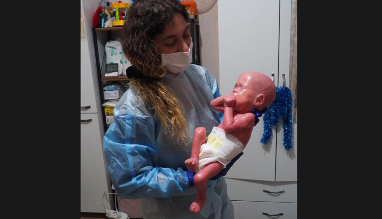 ‘Yılan bebek’ Gökdeniz 1 yaşında. Çıplak elle dokunulması öpülmesi yasak