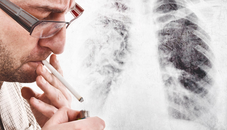 Sigara kullananlar korona virüsü daha ağır geçiriyor