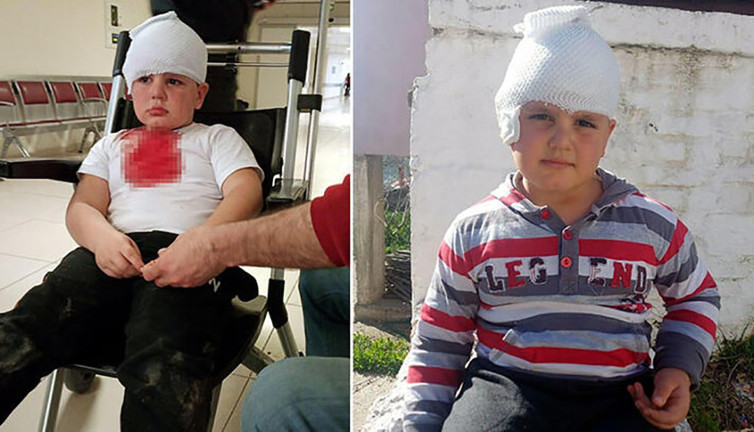Pitbull melezi 6 yaşındaki Hüseyin'i paramparça etti! Artık bu vahşete dur deyin…