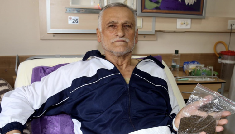 Safra kesesinden binlerce taş çıkarıldı: Guinness'e başvuracak