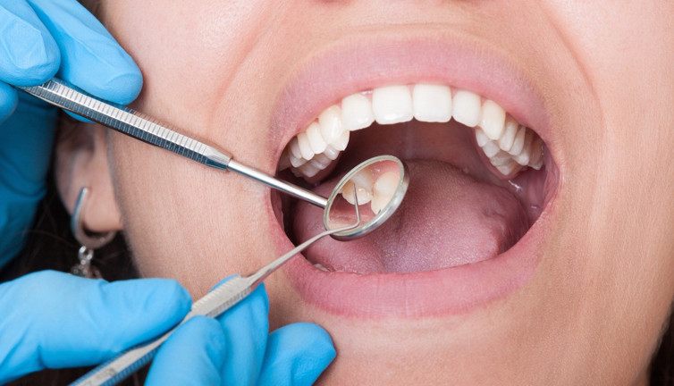 Diş çürüklerini önlemek için tavsiyeler