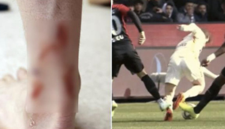 Galatasaray, Kerem'in ayağını paylaştı: Karşılığında kart yok!