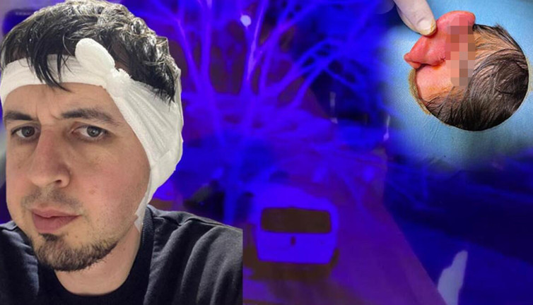 Durdurun bu vahşeti! Durağa yürürken sokak köpekleri saldırdı. Kulağı kopmak üzereydi