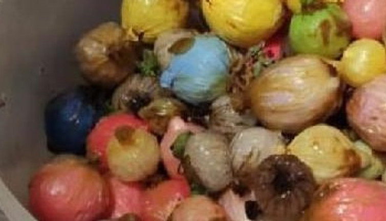 Ölen adamın midesinden çıkanlar şok etti