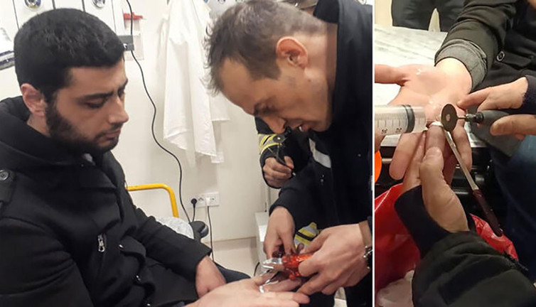 İtfaiyeden acil serviste ‘yüzük’ operasyonu