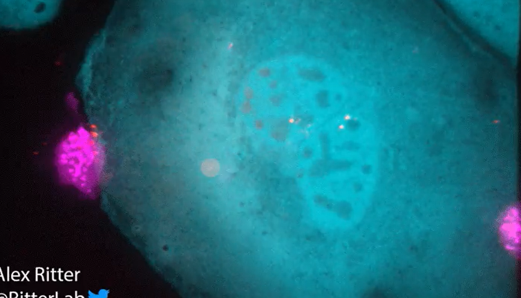 Cüsse her şey değildir. T hücresinin kendisinden kat kat büyük bir kanser hücresini yok ediş anı