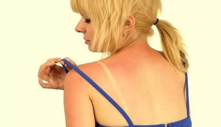 Cilt bakım uzmanından önemli uyarı: Uzun süre güneşte kalanlar dikkat