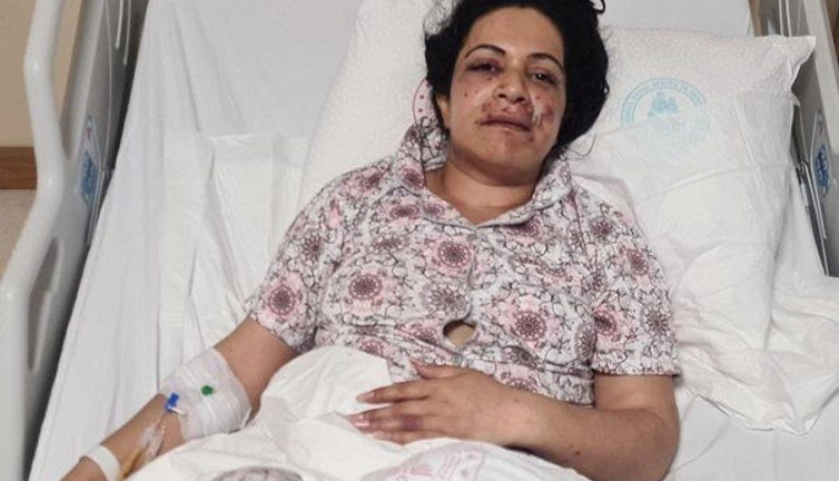 Kıskanç elti gelini ağzından vurdu