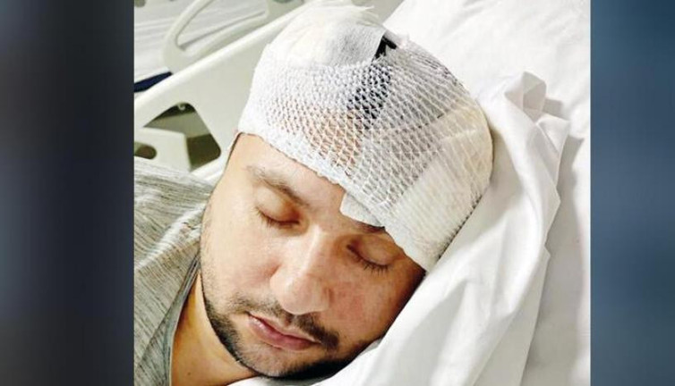 6 taksici pala ve sopalarla müşteriyi dövdü, öldü sanıp bıraktılar. Talihsiz adamın beyninde ödem oluştu