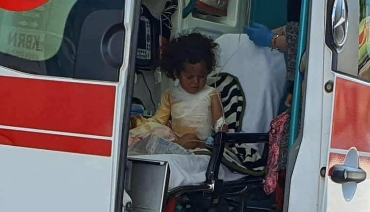 Üzerlerine kaynar su dökülen 2 kardeş yaralandı