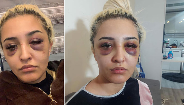 Eski sevgili dehşetinde şok eden gelişme. 3 saat aralıksız dayak yemişti