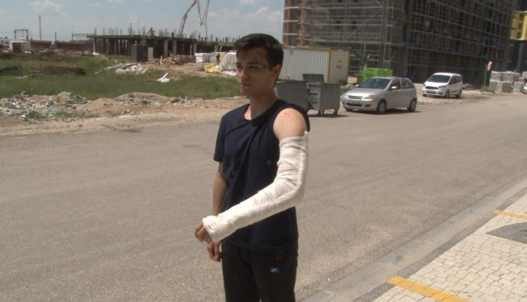 Üniversiteli gence sokak köpekleri 10'uncu kez saldırdı