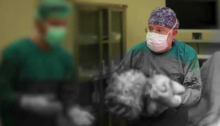 40 yıllık doktor şaşkına döndü. Kadın hastanın karnından çıkarıldı
