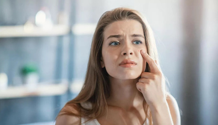 Uzmanı açıkladı. Sivilce karaciğerden mi kaynaklanır?