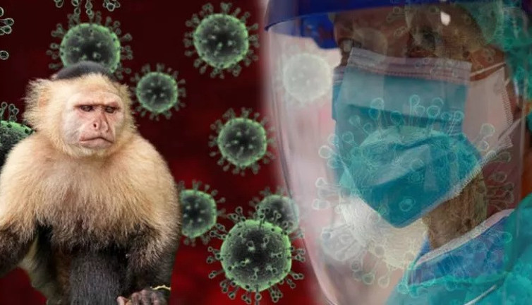 Maymun çiçeği virüsü 1 can aldı