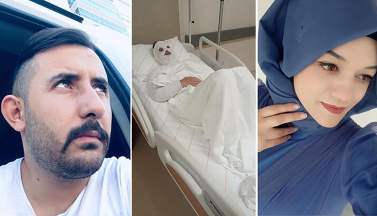 Ortaya çıkan ifadesi pes dedirtti. Eski nişanlısının yüzüne kimyasal madde atmıştı. Bu hale getirdi bir de şikayetçi oldu