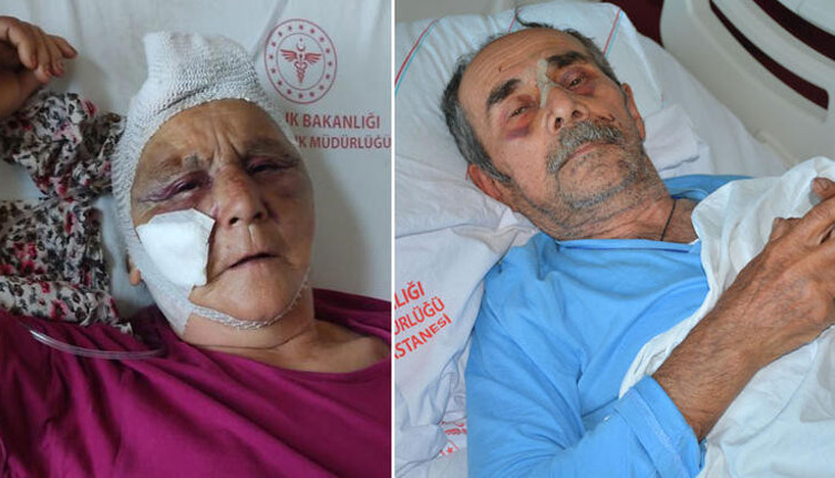 Olmaz olsun böyle evlat! Para vermeyen anne ve babasını bu hale getirdi…