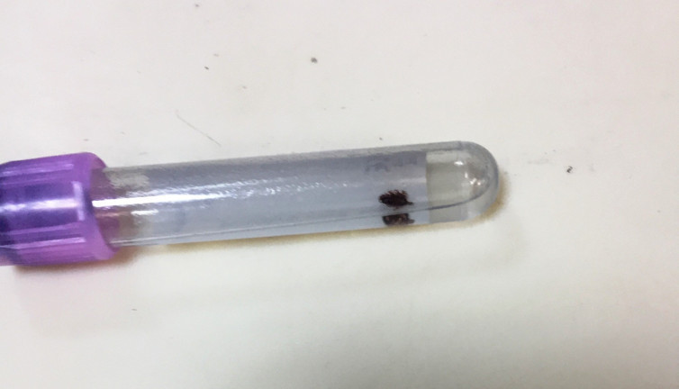 O ilimizde kene paniği