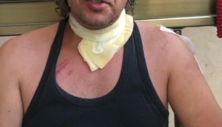 Alkollü yolcu taksi şoförünü ısırdı, darbetti, aracına binip kaza yaptı