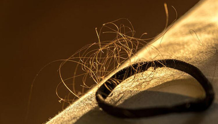 Sofranızdan eksik etmeyin. Saç dökülmesini anında kesiyor