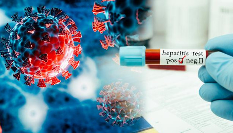 Bir bela daha yayılıyor! Gizemli hepatit vaka sayısı 1000'i geçti
