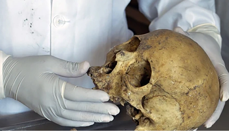 Kardeşinin iskeletini çöpe attı: Tutuklanınca herkesi şok eden o açıklamayı yaptı