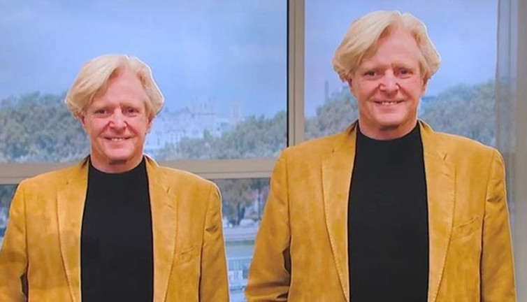 68 yaşındaki adam boyunu uzatmak için servet ödedi. Son halini görenler şaştı kaldı