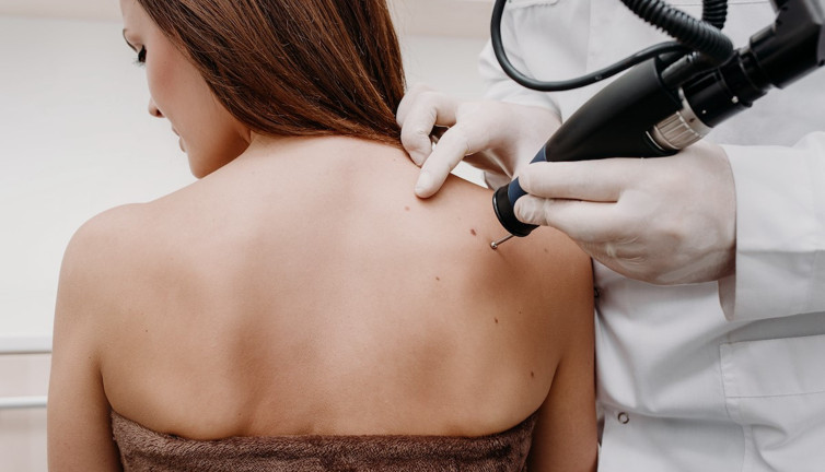 Çarpıcı araştırmadan korkutan cilt sorunu sonuçları