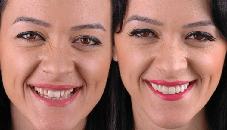 Diş hekimi özgüvenin sırrını açıkladı