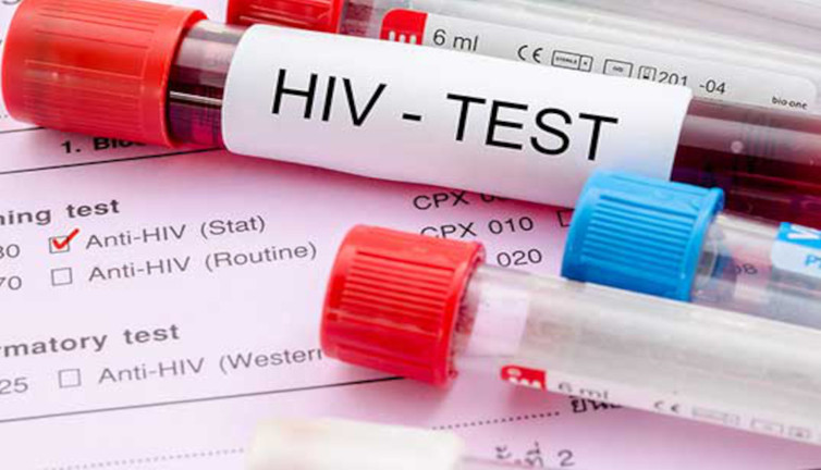 HIV enfeksiyonuyla ilgili uzmanından sevindiren haber
