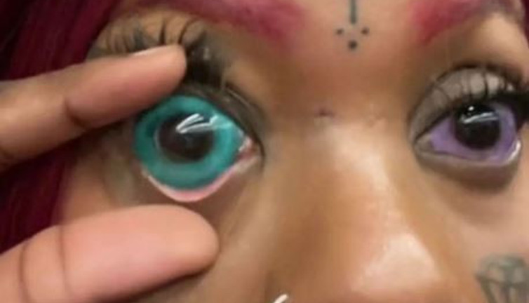 Göz bebeklerine mavi dövme yaptırdı. Hayatının kabusunu yaşadı