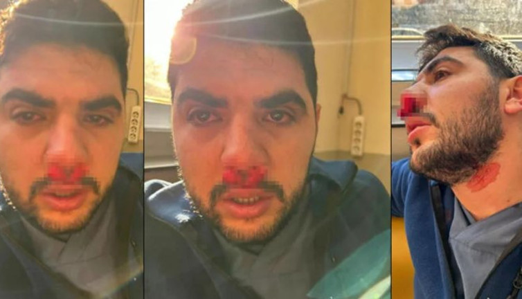 Yer: İstanbul! Hasta yakınından hemşireye yumruklu saldırı