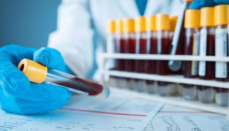 Bu kan grubuna ait olanlar yandı. Riski yüzde 51 daha fazla