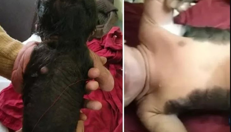 Yenidoğan bebek 'kurt adam' olarak doğdu. Doktorları bile hayrete düşürdü