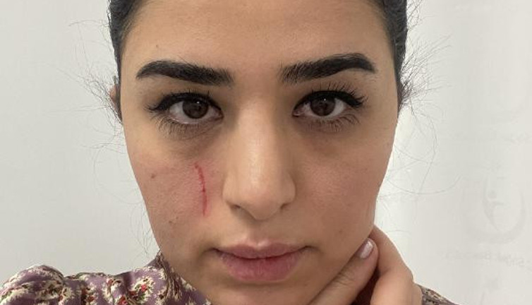 Kadın doktora darp. 'Beyaz Kod' bildirimi yaptı 2 gözaltı