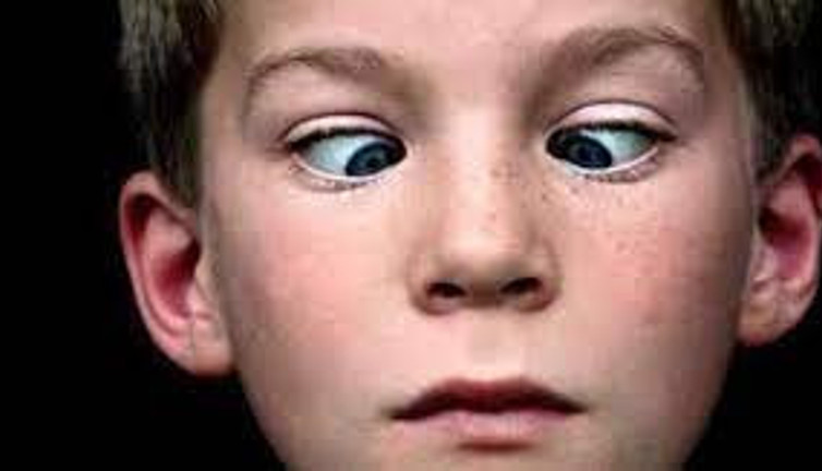 Çocuklarda yalancı şaşılık nedir nasıl anlaşılır?
