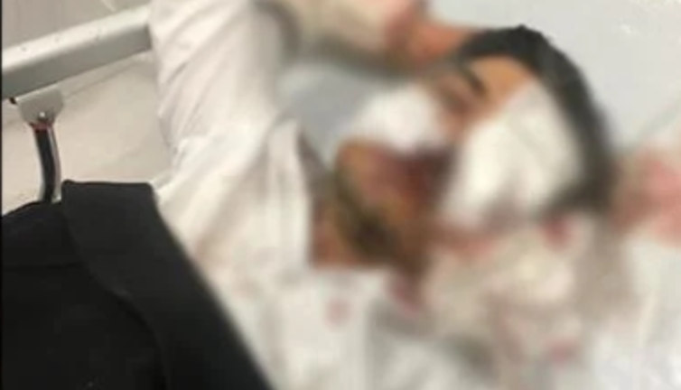 Sivas Ziraat Odası Genel Sekreteri saldırıda ağır yaralandı