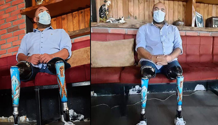 Deprem felaketinde destek için bölgede. 17 Ağustos'ta iki bacağını kaybetti