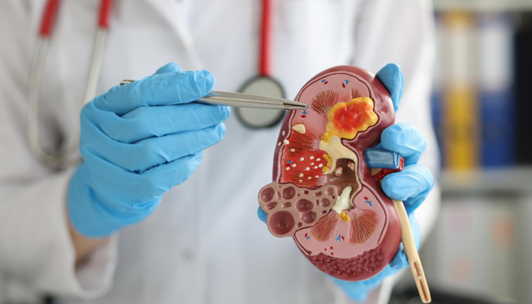 Böbrek taşlarını düşürüyor. Dikkat çeken ot