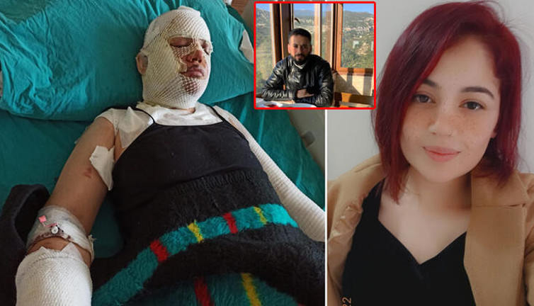 Depremzede eski eşini kaynar suyla yaktı. 'Artçı sarsıntı nedeniyle oldu' dedi