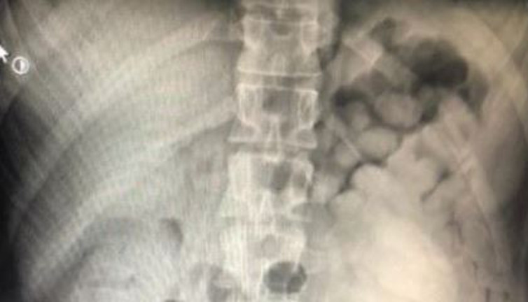 Hastanın röntgenine bakan doktor şok geçirdi