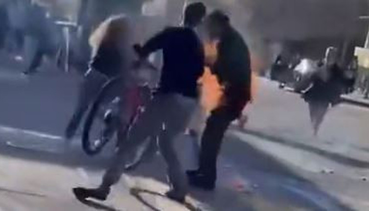 Kendini yakan kişiye sıra dışı müdahale