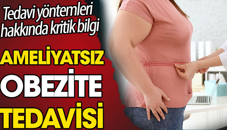 Ameliyatsız obezite tedavisi. Tedavi yöntemleri hakkında kritik bilgi