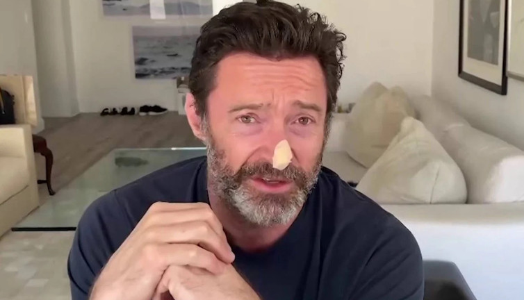 Hugh Jackman'ın test sonuçları çıktı. Cilt kanseri şüphesiyle biyopsi yaptırmıştı