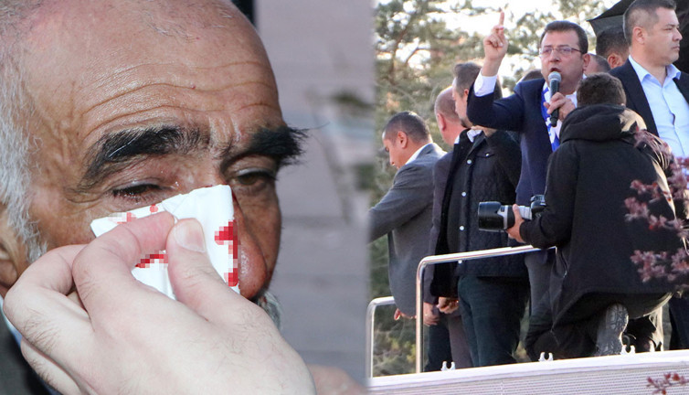 İmamoğlu'nun mitinginde taşlı saldırıda yaralanan 17 kişi taburcu edildi