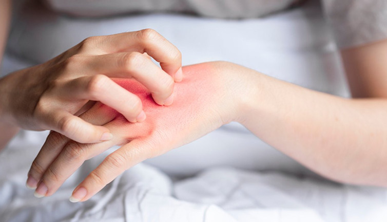 Mucize bitki mantara iyi geliyor